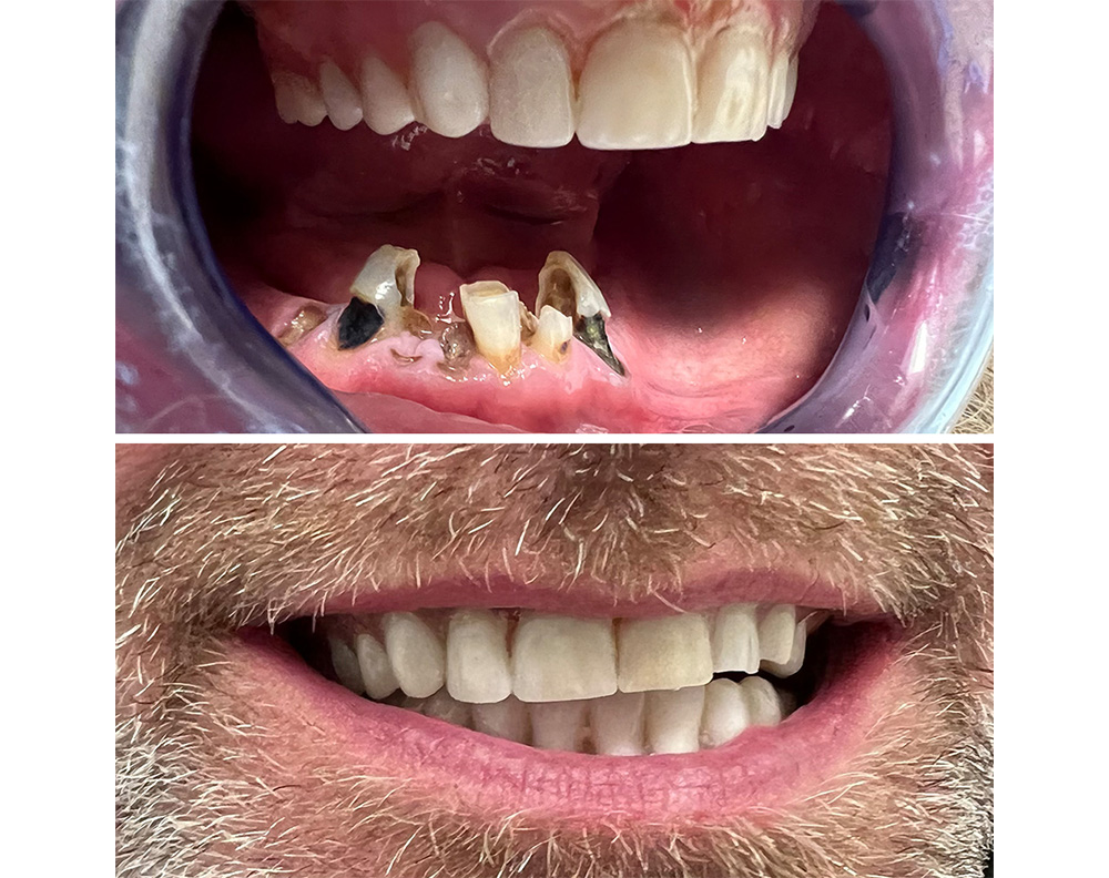 Before After image
